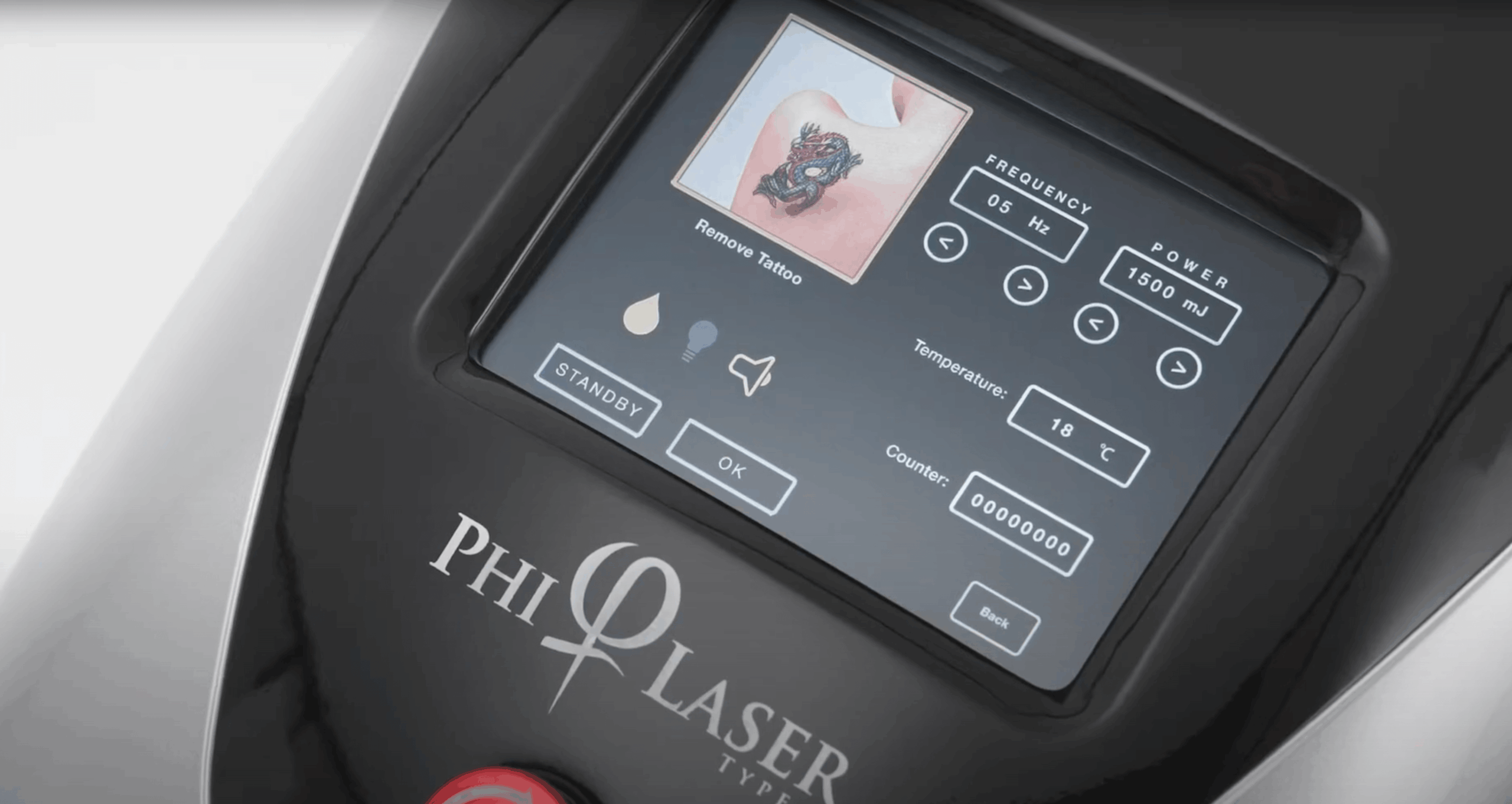 Tattoo removal